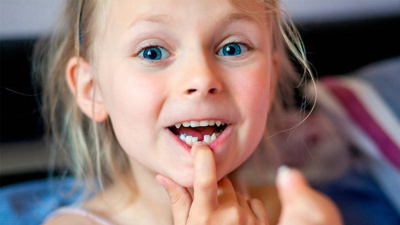 Bambina che ha perso il suo primo dente da latte